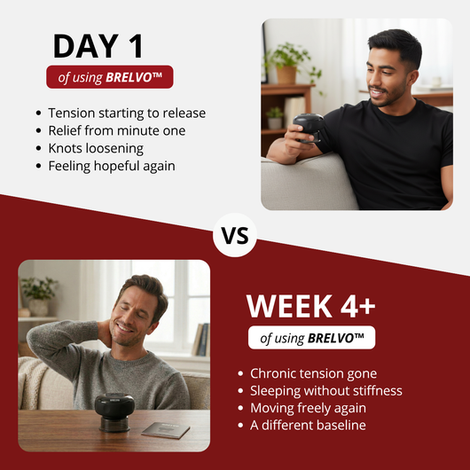 BRELVO™ Smart Cupping Therapy